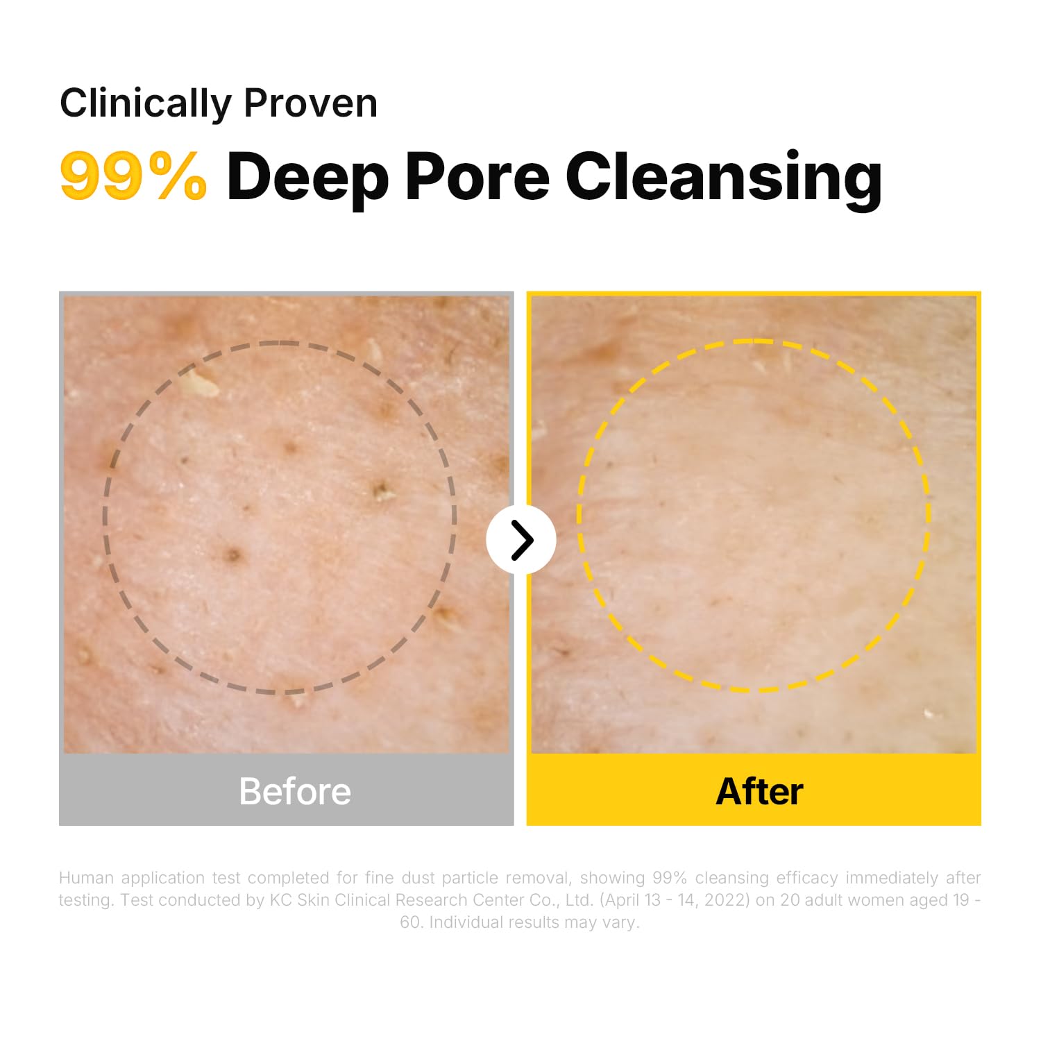 ma:nyo Pure Cleansing Oil – Tiefenreinigendes Reinigungsöl (200 ml)