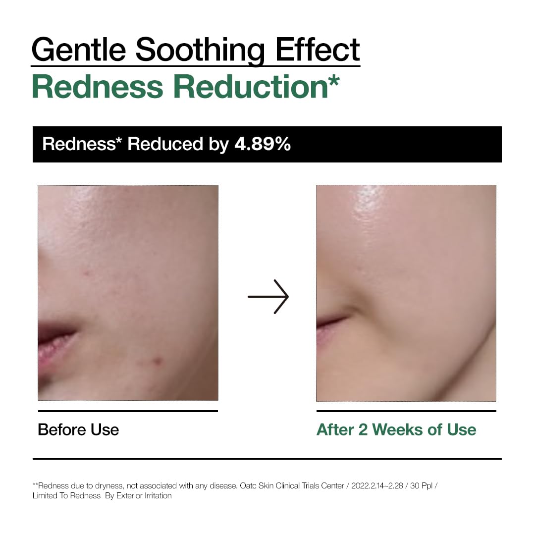 Anua – Heartleaf 80 % Moisture Soothing Ampoule 30 ml