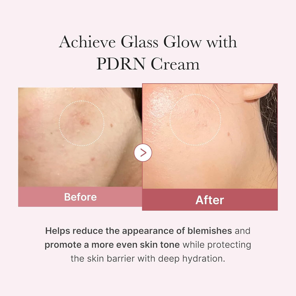 Medicube PDRN Pink Hyaluronic Cream Gesichtscreme 50 ml