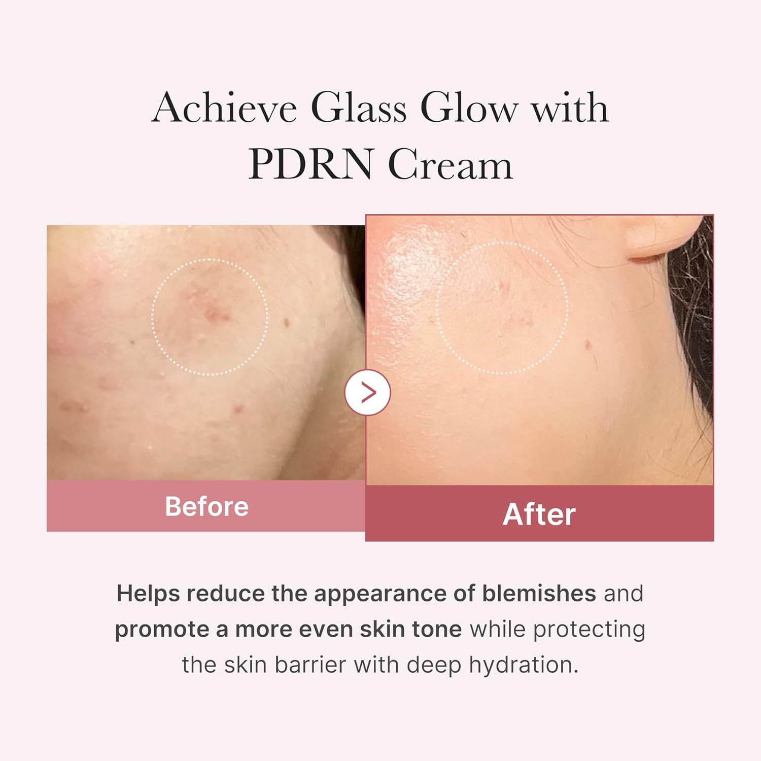 Medicube PDRN Pink Hyaluronic Cream Gesichtscreme 50 ml