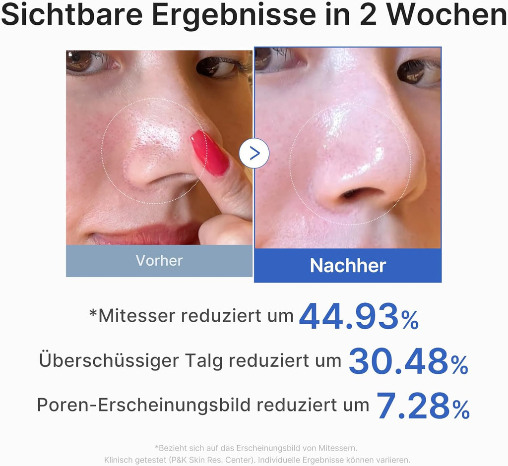 Medicube – Zero Pore Pad 2.0 - 70 Stück