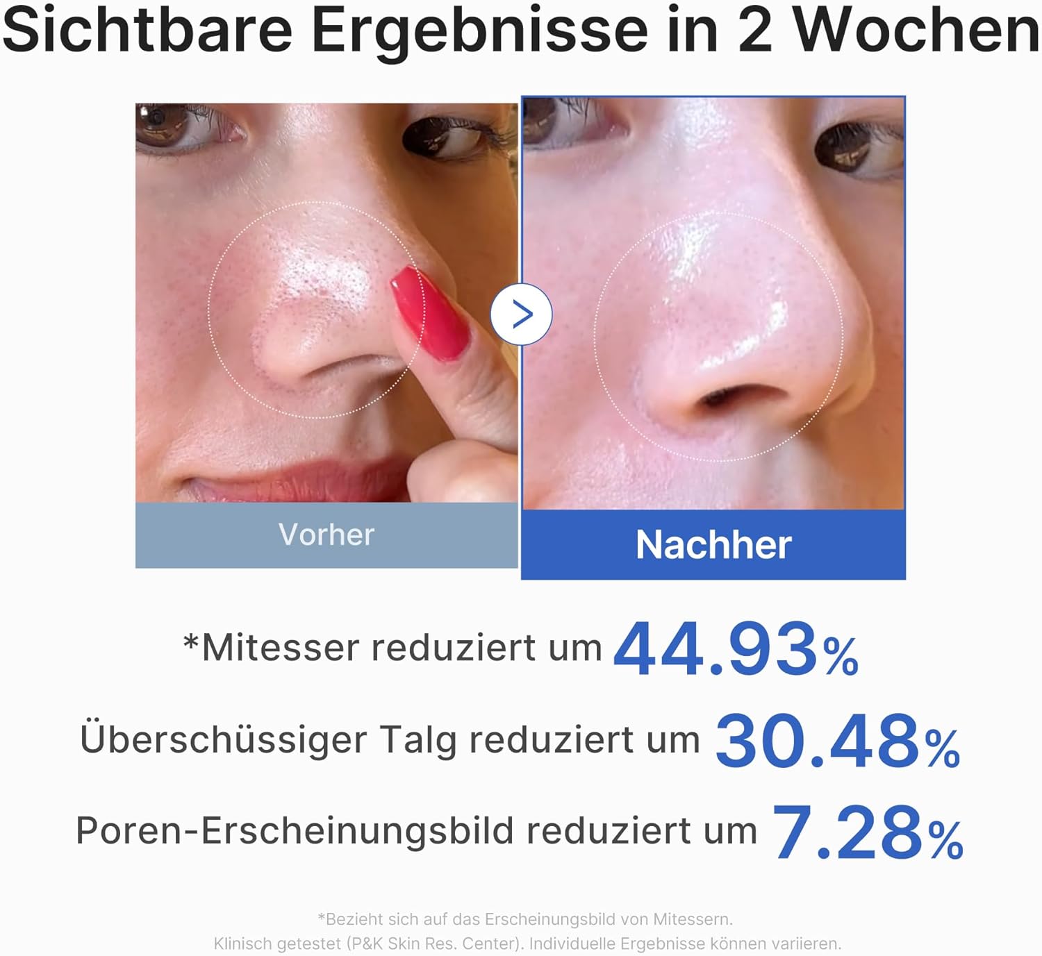 Medicube – Zero Pore Pad 2.0 - 70 Stück