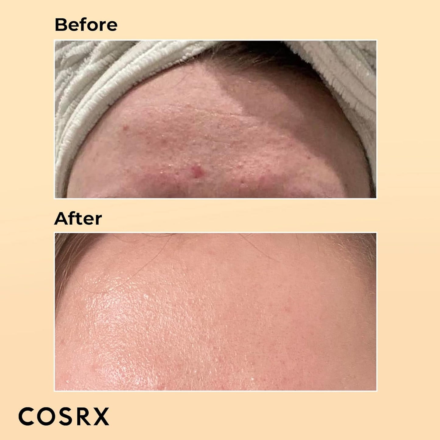 COSRX Advanced Snail 96 Feuchtigkeitsspendende Essenz Mucin Power Essence 100 ml