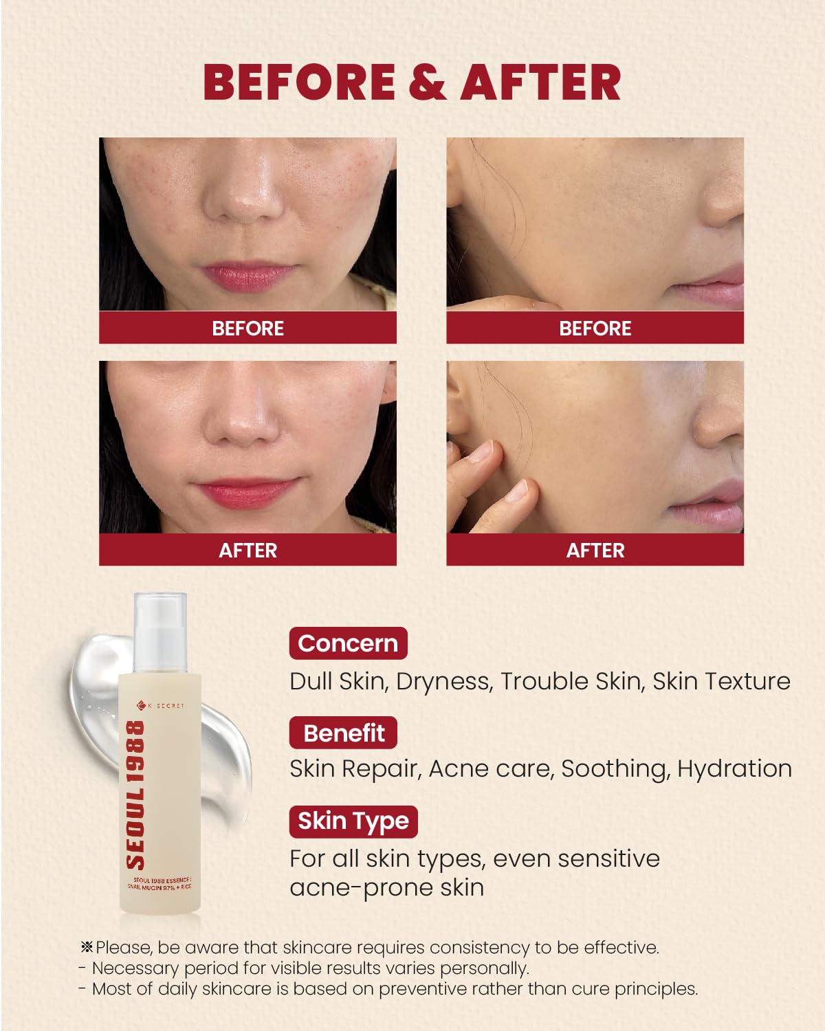 K-Secret Seoul 1988 Essence: Snail Mucin 97% + Rice