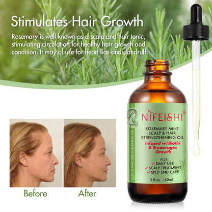 Nifeishi Rosmarinöl Haare und Silikon Kopfhaut Massagebürste, Rosemary Oil for Hair, Stärkendes Öl für Gesundes Haarwachstum