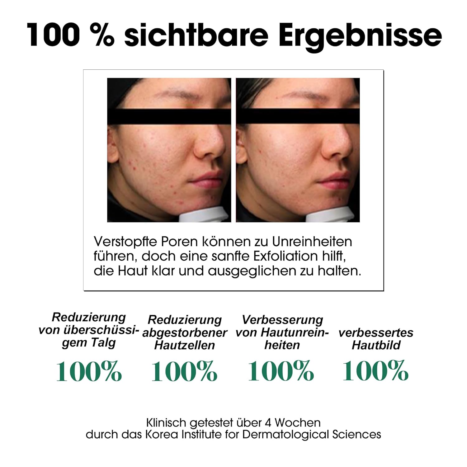 SOME BY MI AHA BHA PHA 30 Days Miracle Toner – 150ml