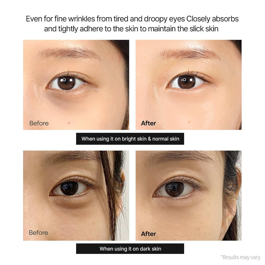 Dr.Melaxin Cemenrete Calcium Dark Spot Cover Augencreme 15 g