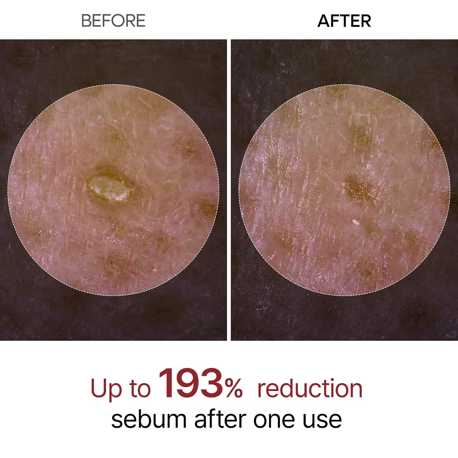 Dr.Melaxin Peel Shot Glow White Rice Peeling Ampulle, 80ml