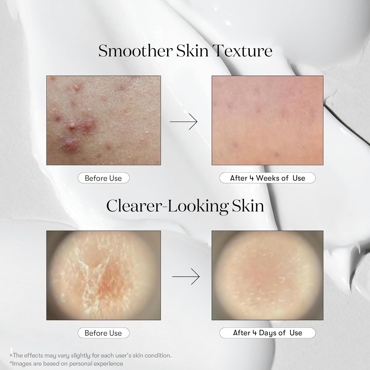 VT Cosmetics Reedle Shot 300 Microneedling-Serum 50 ml