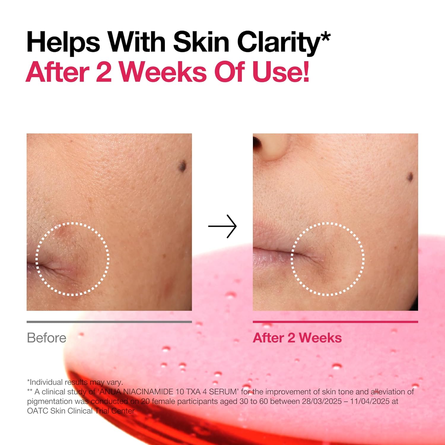 ANUA 10% Niacinamid + 4% TXA Serum, 30 ml