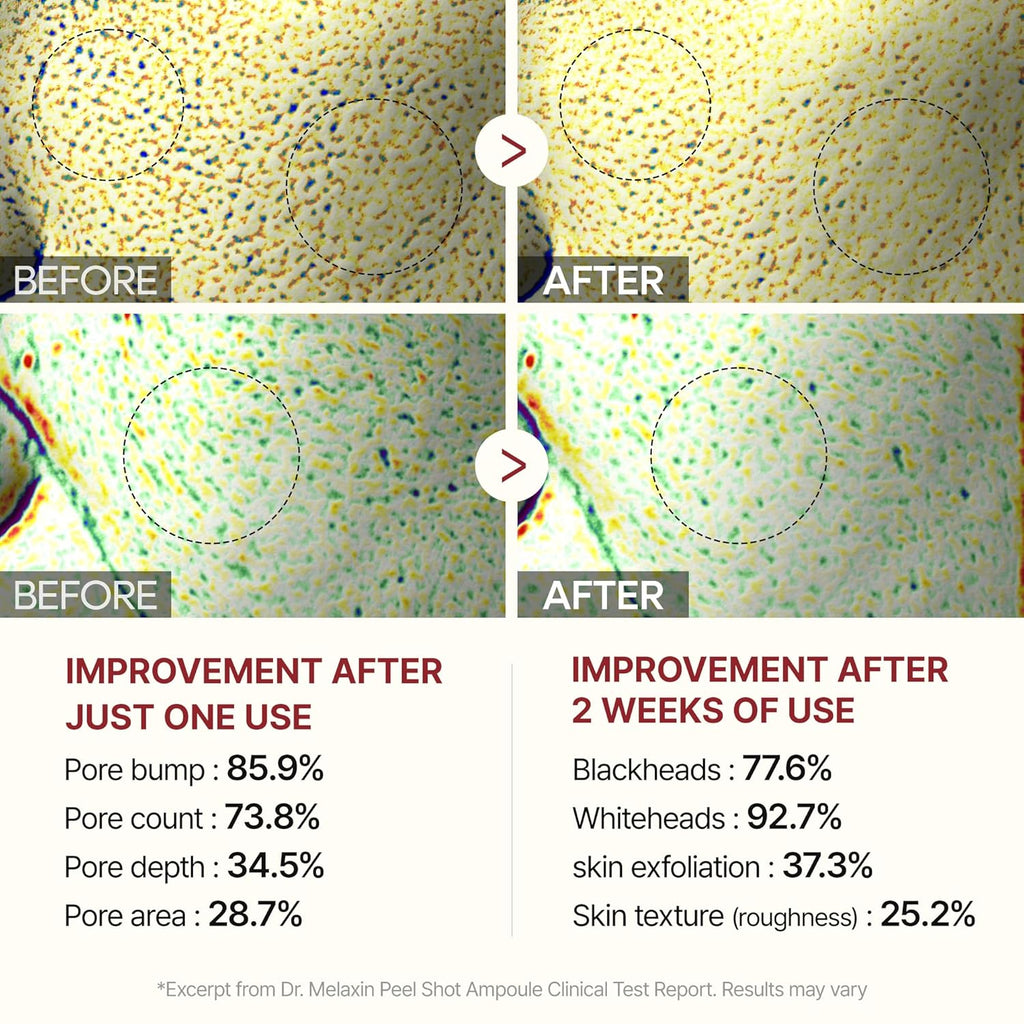 Dr.Melaxin Peel Shot Glow White Rice Peeling Ampulle, 80ml