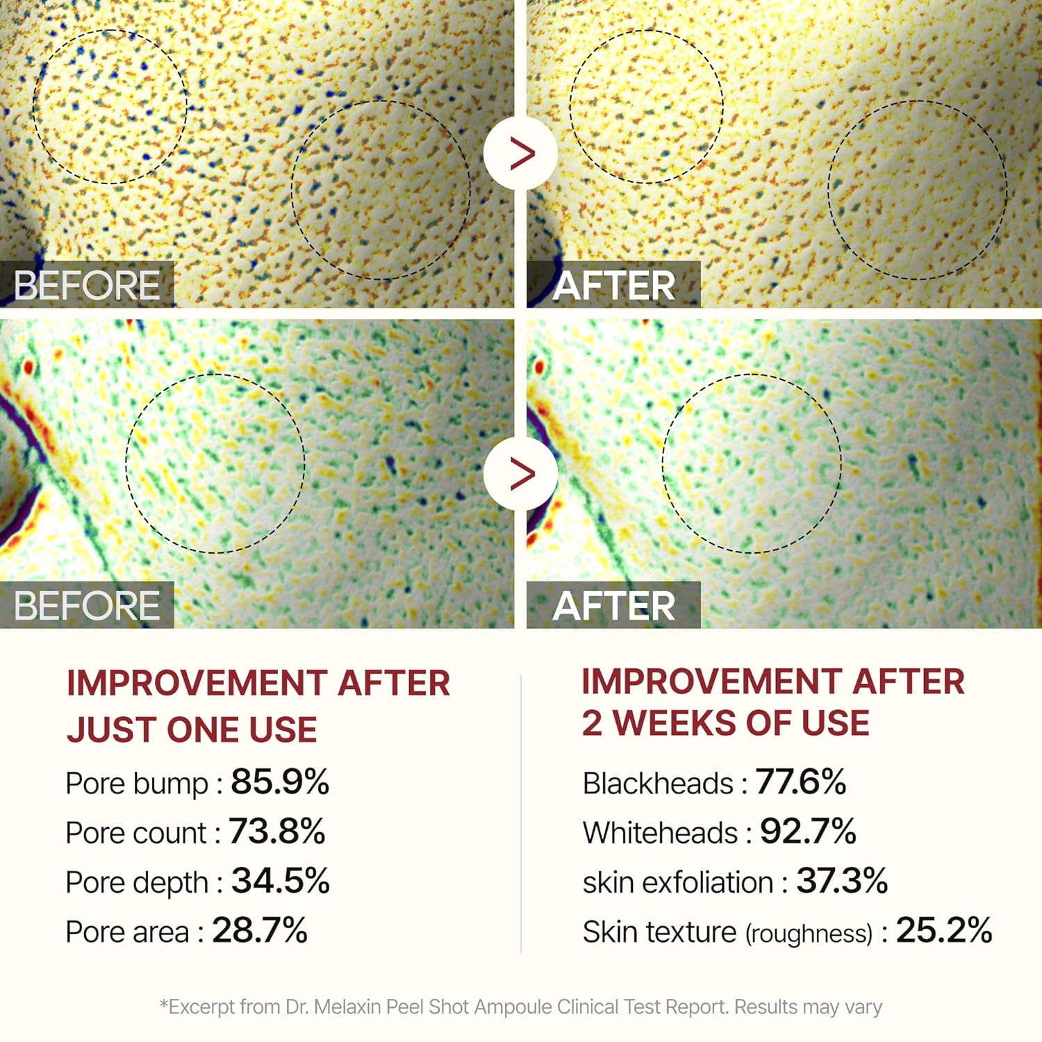 Dr.Melaxin Peel Shot Glow White Rice Peeling Ampulle, 80ml